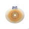 Coloplast Sensura Click Xpro Platen 50/10-45Mm 5 10025 - Product 1