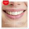 Colgate Max White Kit Blancheur Led 2 Produits - Utilisation 2