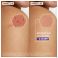 A-Derma Aderma Epitheliale Creme A/vlekken 100Ml - Gebruik 5