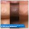 Cerave Patchs A/imperfections 22