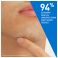 Cerave Patchs A/imperfections 22