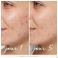 La Rosee Serum Purif.a/imperf.zn&acid.frui.bio30ml