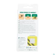 Quitmo Bee Sting Patch 5