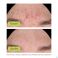 Aderma Biology Ac Night Peel Serum A/imperf. 30ml
