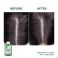 Klorane Capil. Sh Brandnetel 200ml Nf