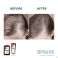 Klorane Capil. Condit. Kinine & Edelweiss 50ml